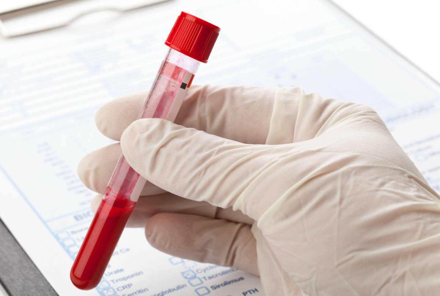 Blut, Blutprobe, Latex Handschuh http://www.shutterstock.com/de/pic-173050052/stock-photo-hand-with-latex-glove-holding-blood-sample-vial-in-front-of-blood-test-form.html